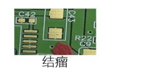 结l瘤检测 结l瘤检测